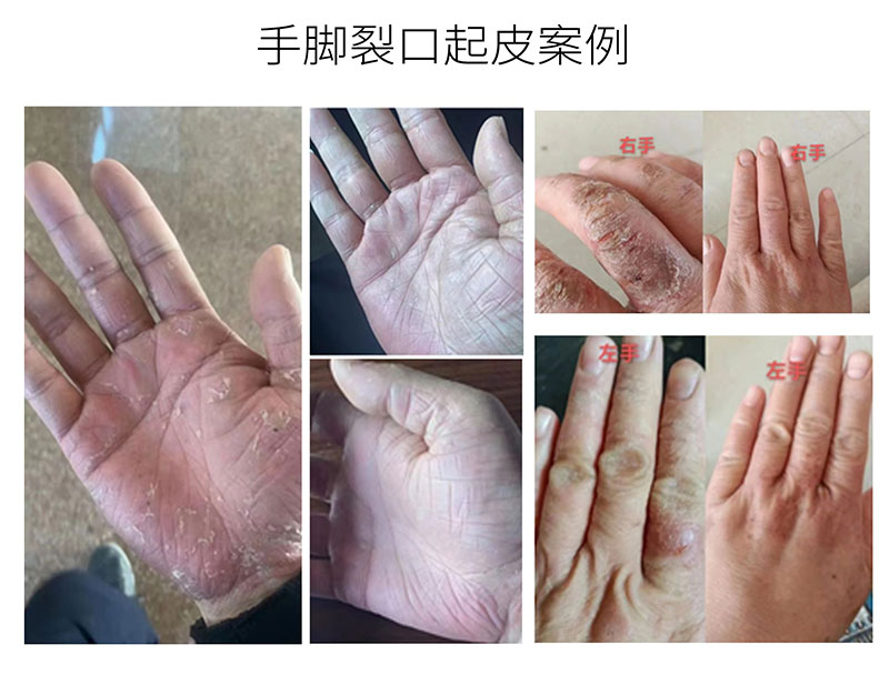 芦丽抗菌液详图_08.jpg