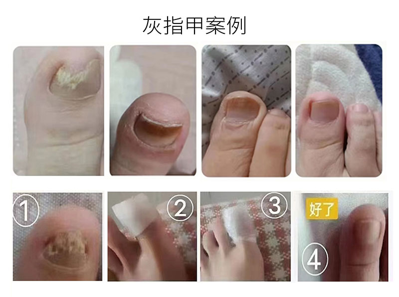 芦丽抗菌液详图_05.jpg