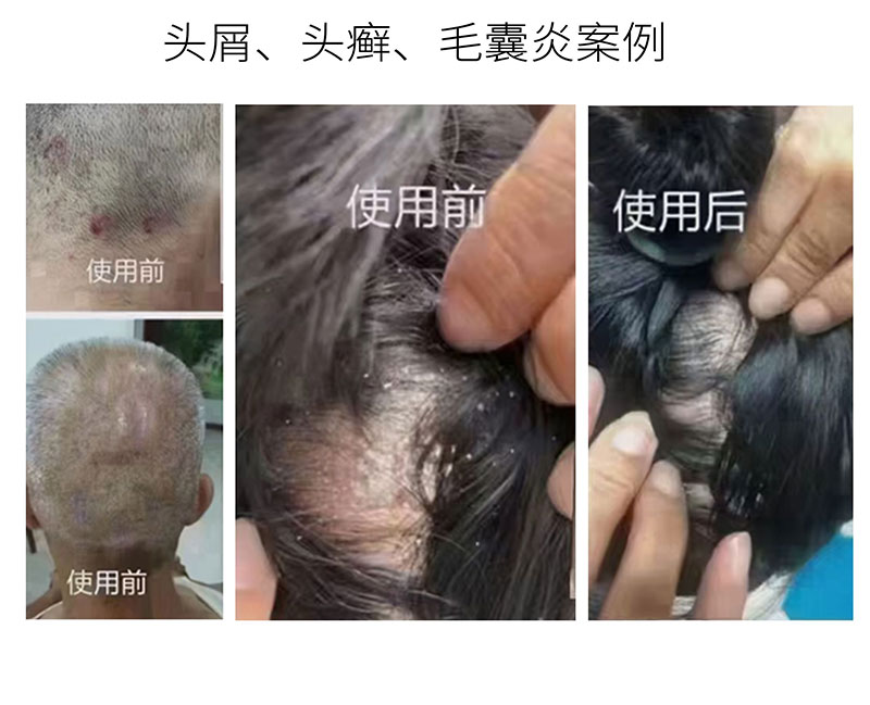 芦丽抗菌液详图_09.jpg