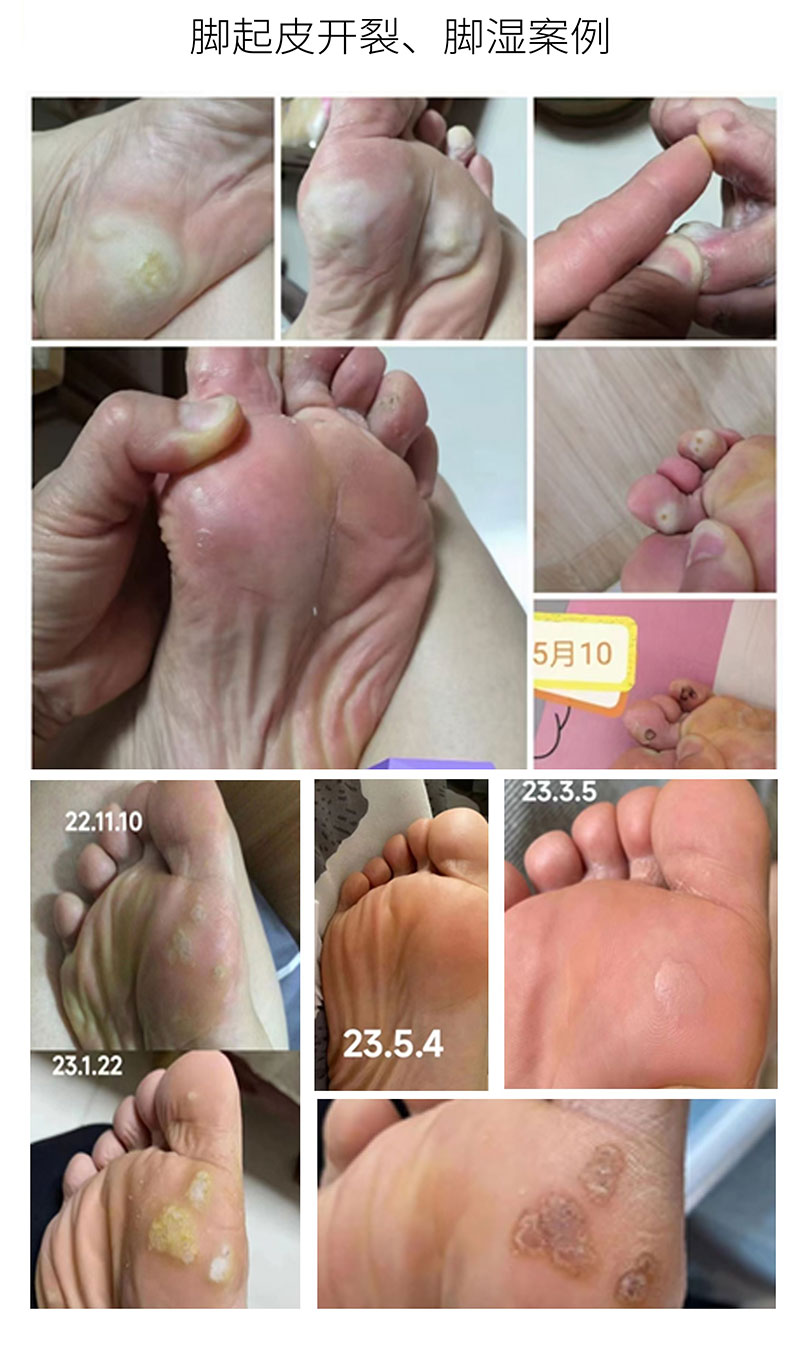 芦丽抗菌液详图_06.jpg