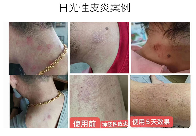 芦丽抗菌液详图_07.jpg